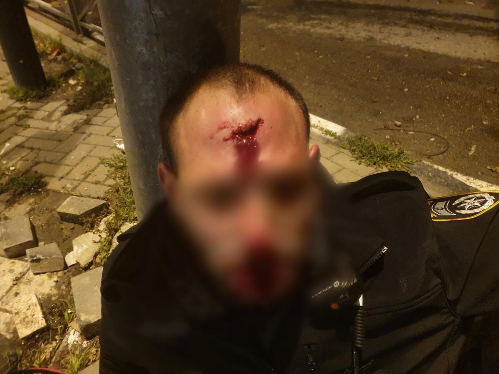 שוטר שנפגע בעימותים(צילום: דוברות המשטרה)