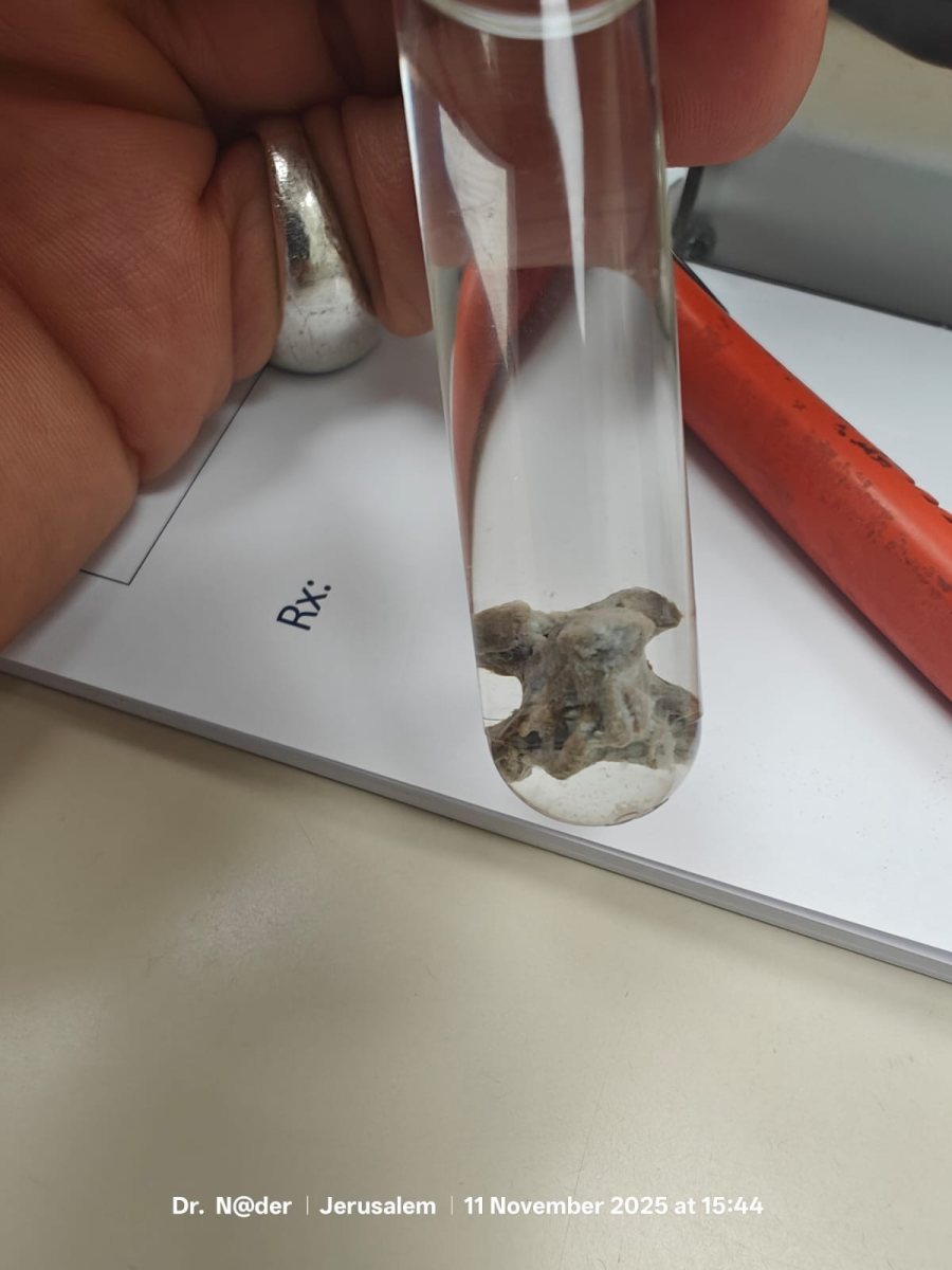 צילום: דוברות שע״צ