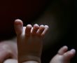 שערי צדק: צנתור נדיר בתינוקת בת שלושה ימים 