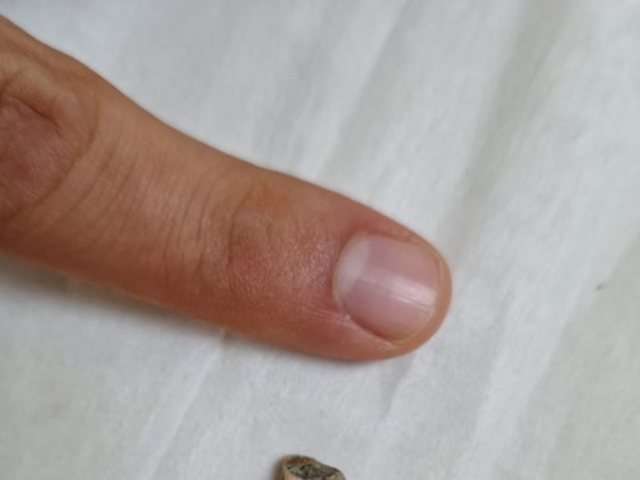 צילום: דוברות שערי צדק 