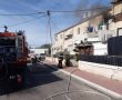 בת 60 חולצה מביתה לאחר שנכוותה באורח קשה: