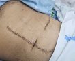 הטירוף חוגג: אב ושני בניו דקרו והכו עד זוב דם צעיר בן 20
