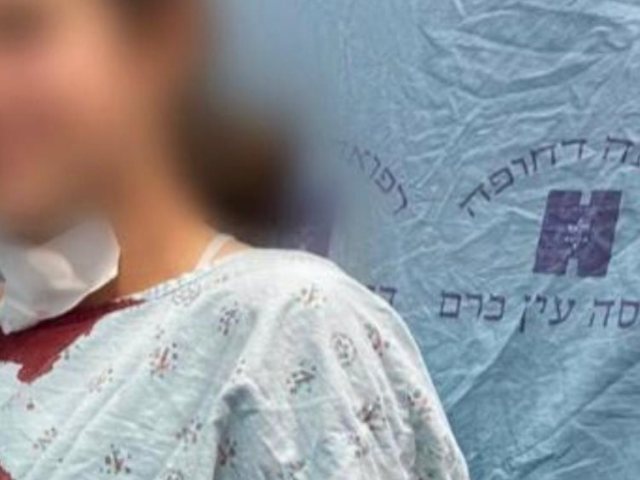 הנערה שנפגעה מגזיה (צילום: דוברות הדסה)