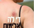ירושלים מציינת את יום המאבק הבינלאומי נגד נשים